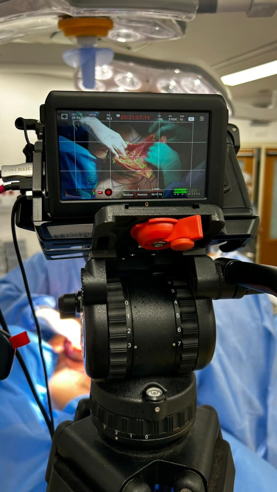 Monitor de câmera com timecode durante transmissão de cirurgia